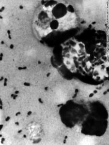 Plague kills dozens in Madagascar